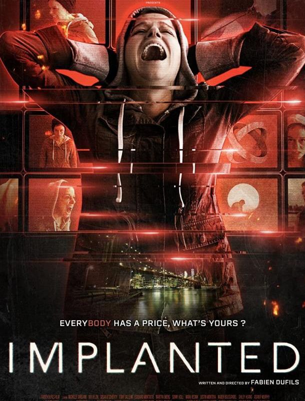 Имплантированная 2021